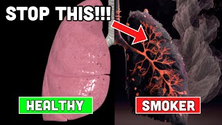 How To Repair Lung Damage Natural Remedies [upl. by Belter]