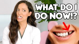 How To REPLACE A Missing Tooth Best Tooth Replacement Options [upl. by Leitman878]