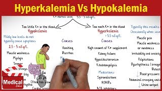 Hyperkalemia Vs Hypokalemia  EASY TO REMEMBER [upl. by Yartnoed]