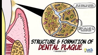 Dental Plaque Structure and Formation [upl. by Harsho278]